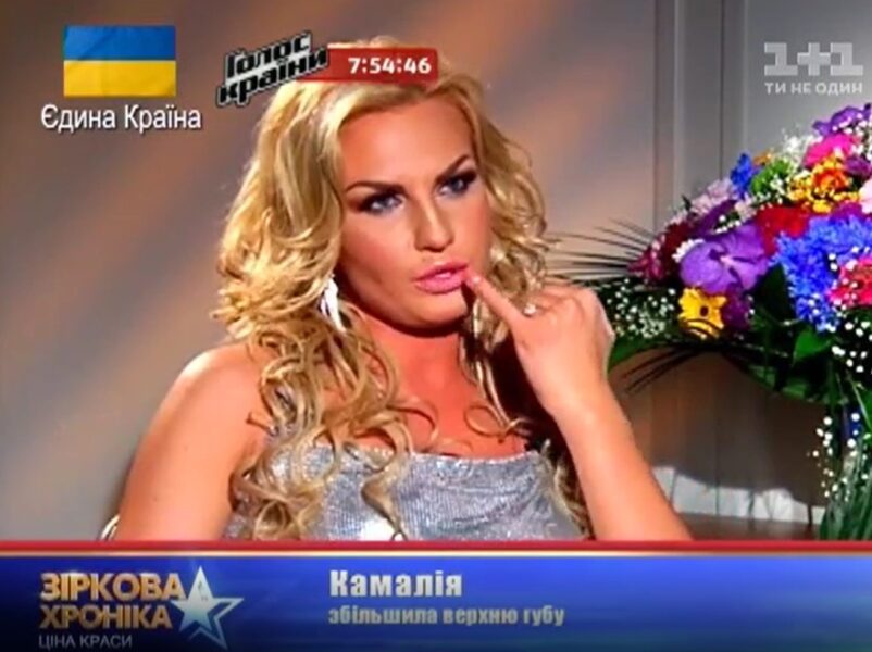 Камалія вперше розповіла, що збільшила собі губи