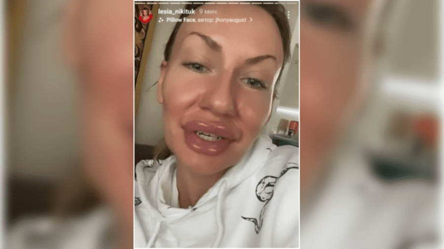 Леся Нікітюк завжди вміла насмішити своїх прихильників, проте ця фотографія їх вибила з колії