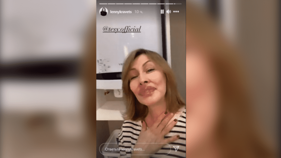 Олена Кравець добряче насмішила своїх прихильників незвичним зовнішнім виглядом зі збільшеними губами