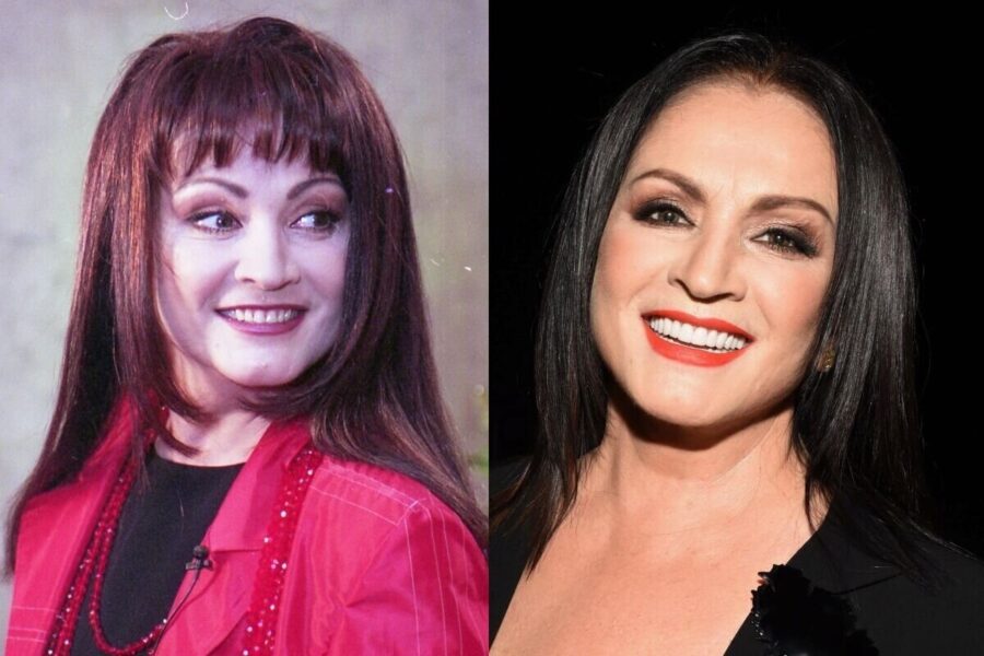 Софія Ротару до та після пластики