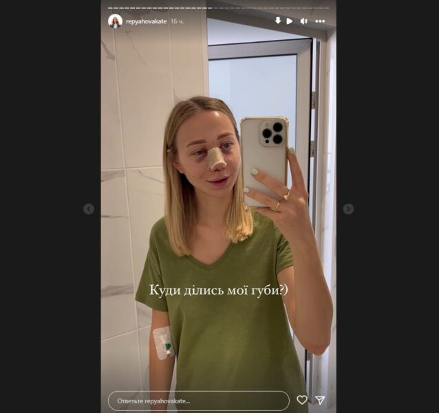 Маленький син Віктора Павліка і Катерини Репяхової не впізнав маму після пластики