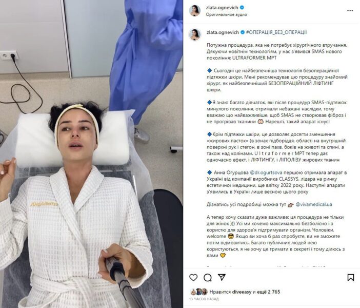 Злата Огнєвіч наважилася на підтяжку обличчя і тепер виглядає на 18