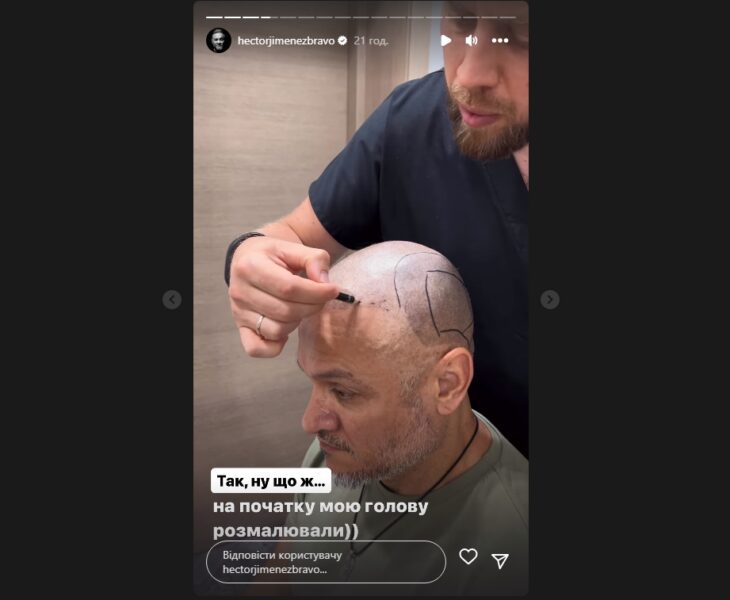 Лисий Ектор Хіменес-Браво зізнався, що без волосся його не впізнають на вулиці