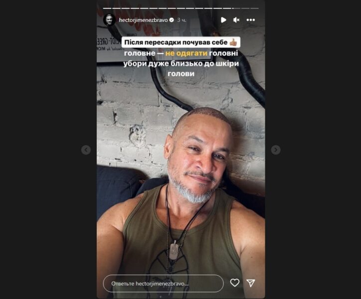 Лисий Ектор Хіменес-Браво зізнався, що без волосся його не впізнають на вулиці