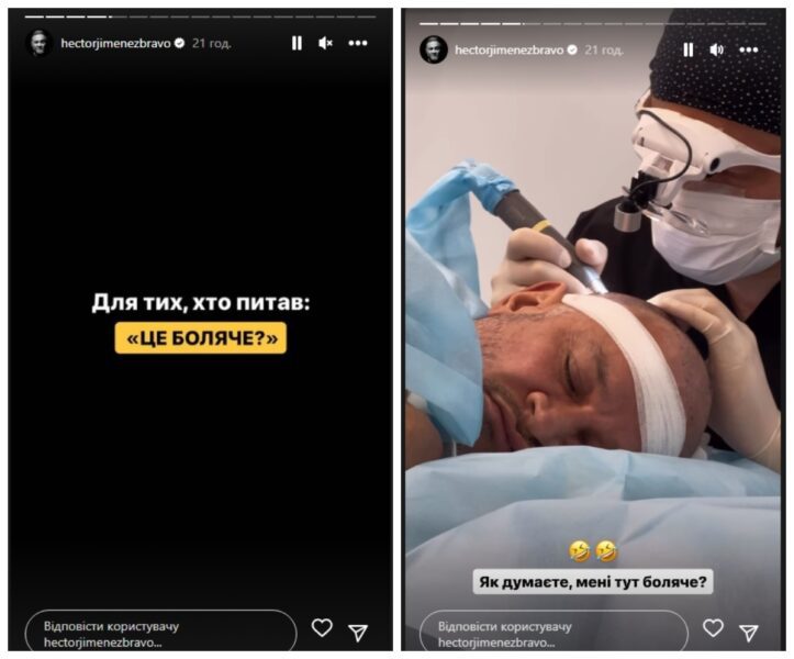 Лисий Ектор Хіменес-Браво зізнався, що без волосся його не впізнають на вулиці