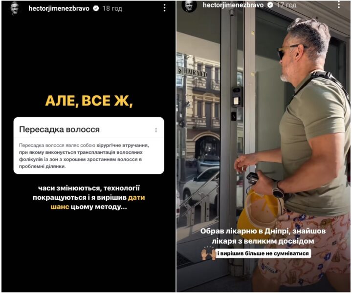 Ектор Хіменес-Браво вразив зізнанням, чому поголився налисо