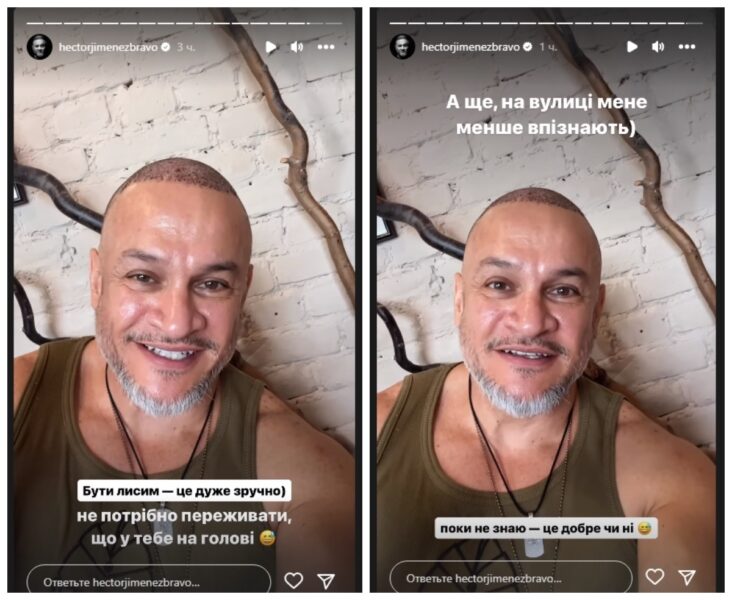 Лисий Ектор Хіменес-Браво зізнався, що без волосся його не впізнають на вулиці