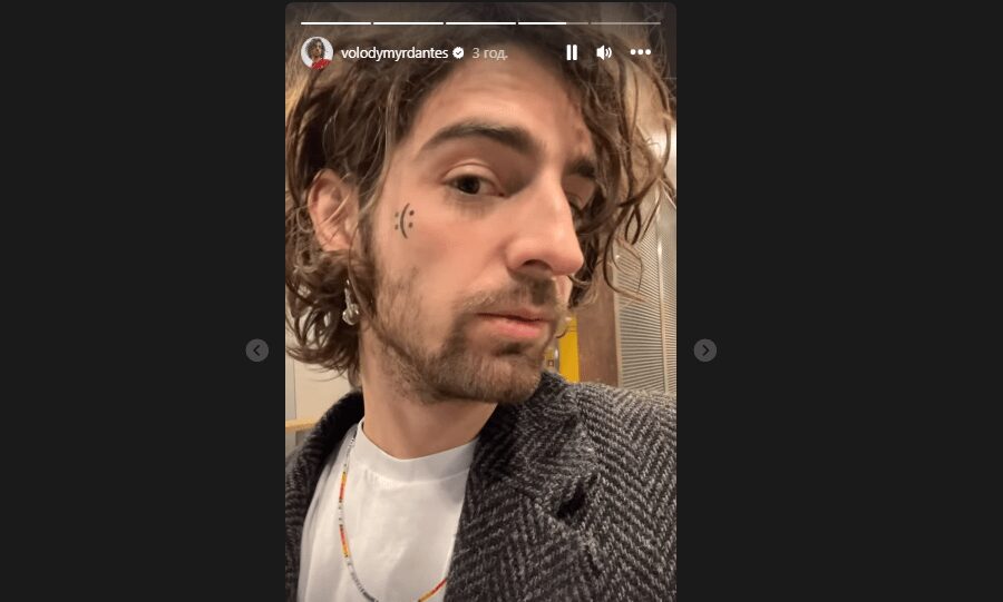 Володимир Дантес після розлучення з Дорофєєвою набив тату на обличчі