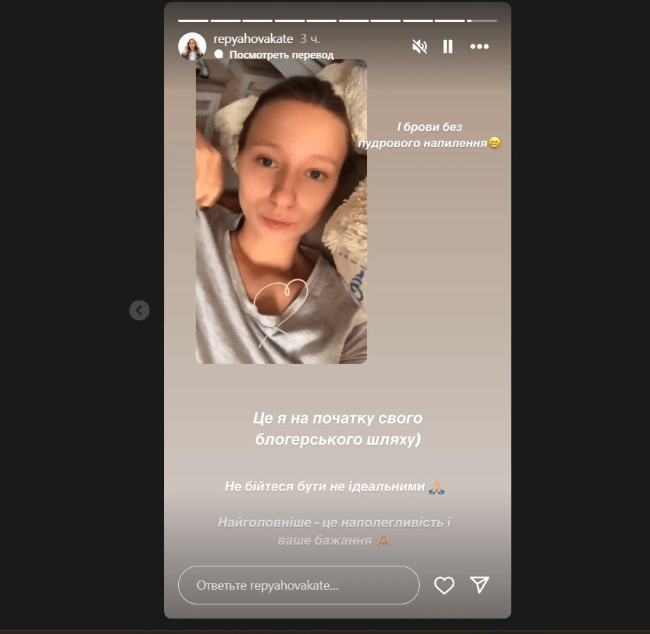 Катя Репяхова показала, як виглядала до пластики та уколів краси