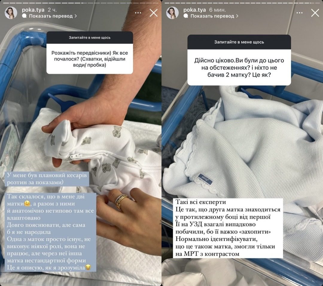 Дружина Володимира Остапчукаподілилася деталями своїх пологів 