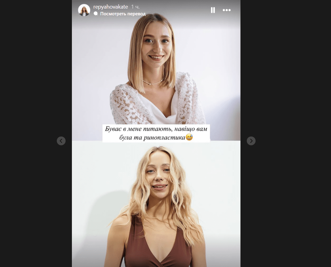 Катерина Репяхова показала себе до та після всіх пластичних операцій