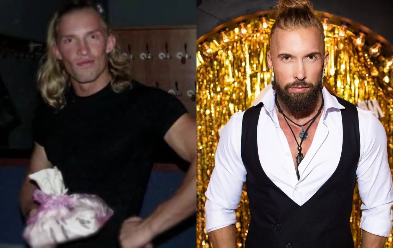 Олексій Суровцев навіть робив пластичну операцію через свою капловухість