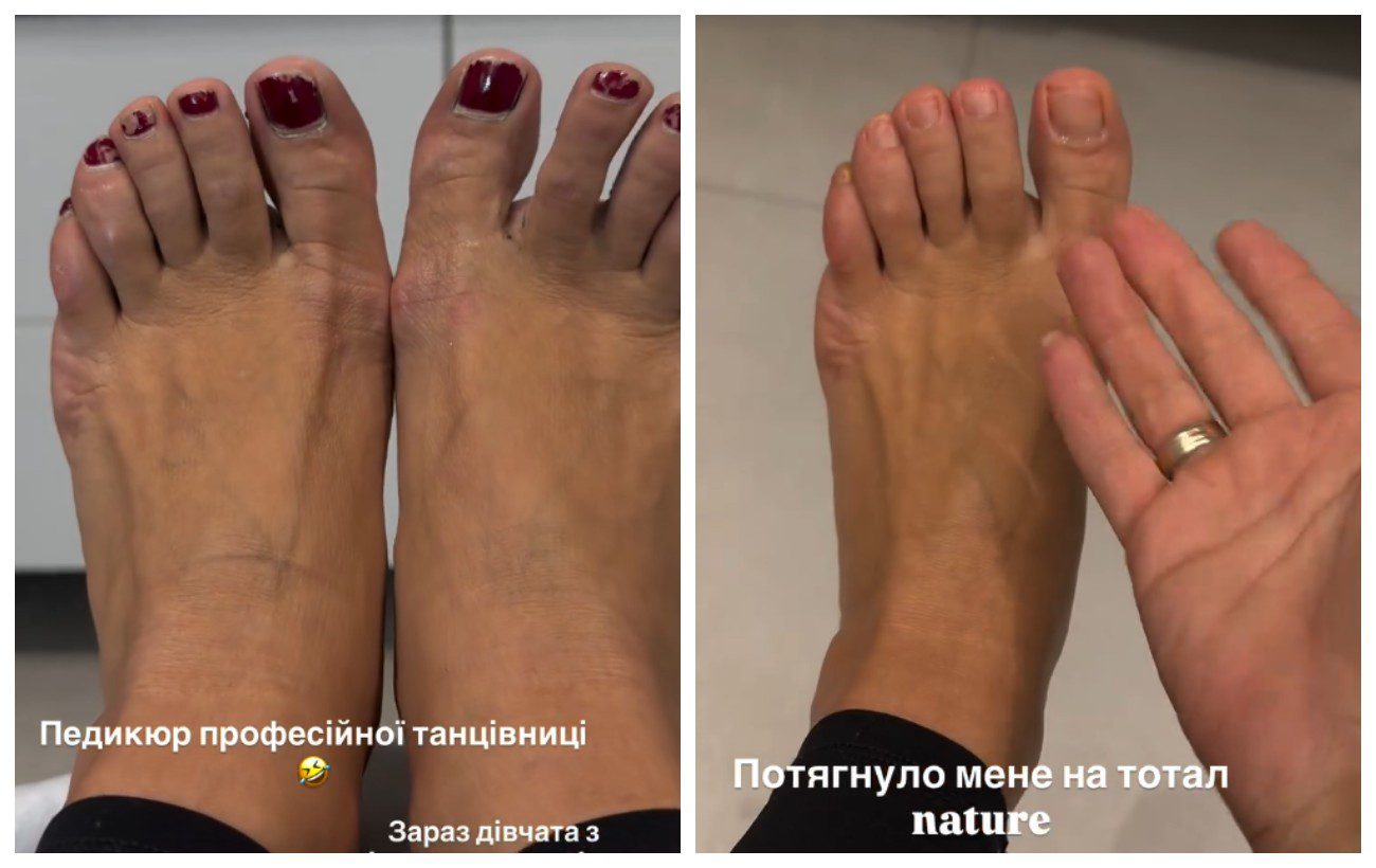 Ілона Гвоздьова показала, як виглядають ноги та педикюр справжньої професійної танцівниці