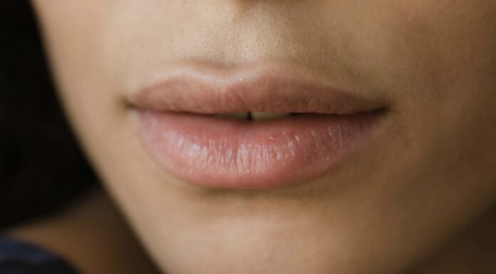 На ніч наношу цей засіб на губи – і зранку вони такі зволожені: жодної пошерхлості й сухості 12 годин Косметологи розповіли, як зберегти губи зволоженими на весь день