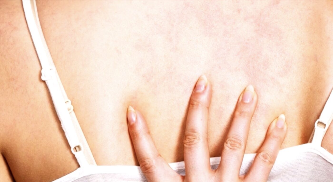 Догляд за надмірно сухою шкірою взимку