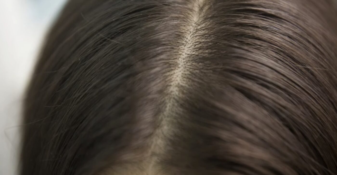 Які натуральні засоби допомагають відростити волосся