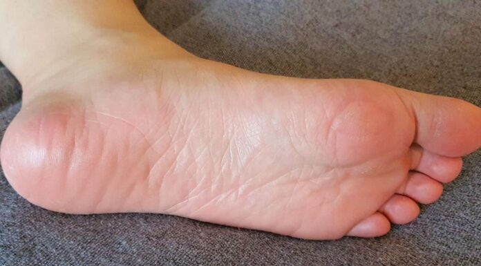 Скраб і крем — у смітник: ось який 1 перевірений засіб реально допоможе зробити п’яти м’якими Як пом'якшити шкіру на п'ятах. Фото: Pixabay