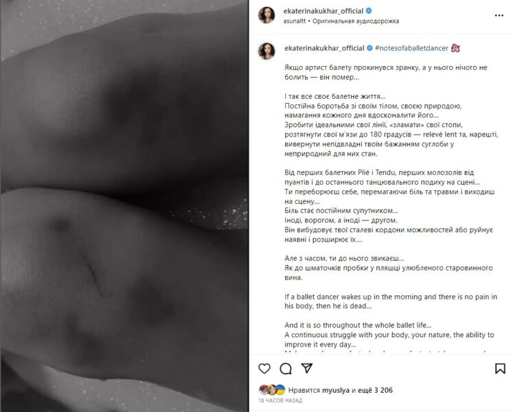 Анастасія Волочкова і Катерина Кухар показали, як зблизька виглядають ноги балерини