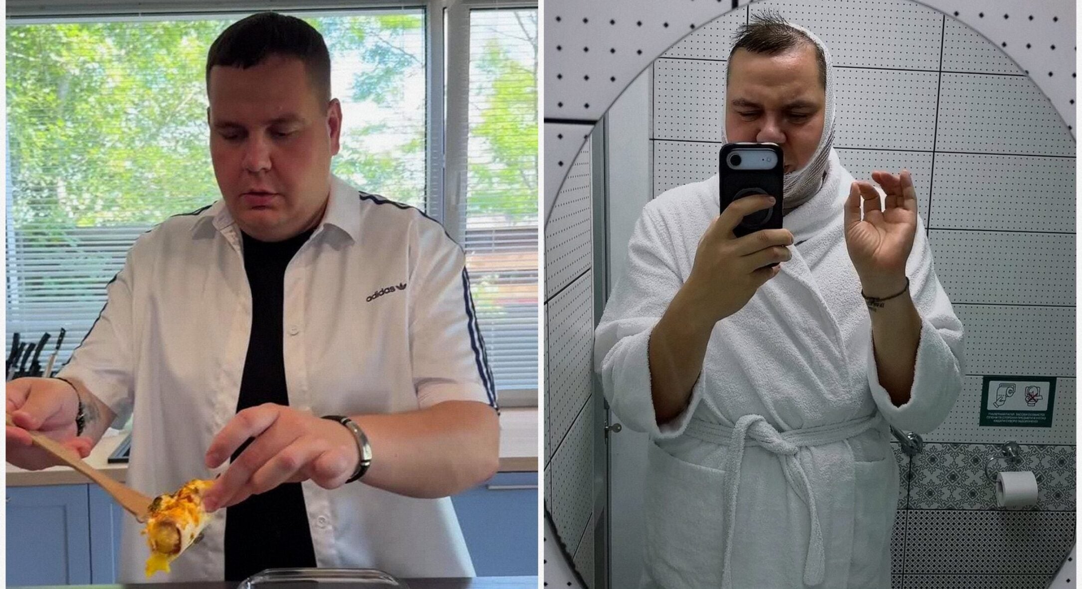 Дмитрейшен із “МастерШеф-13” ліг під ніж, щоб прибрати зайві підборіддя: фанати нахвалюють (ФОТО) 