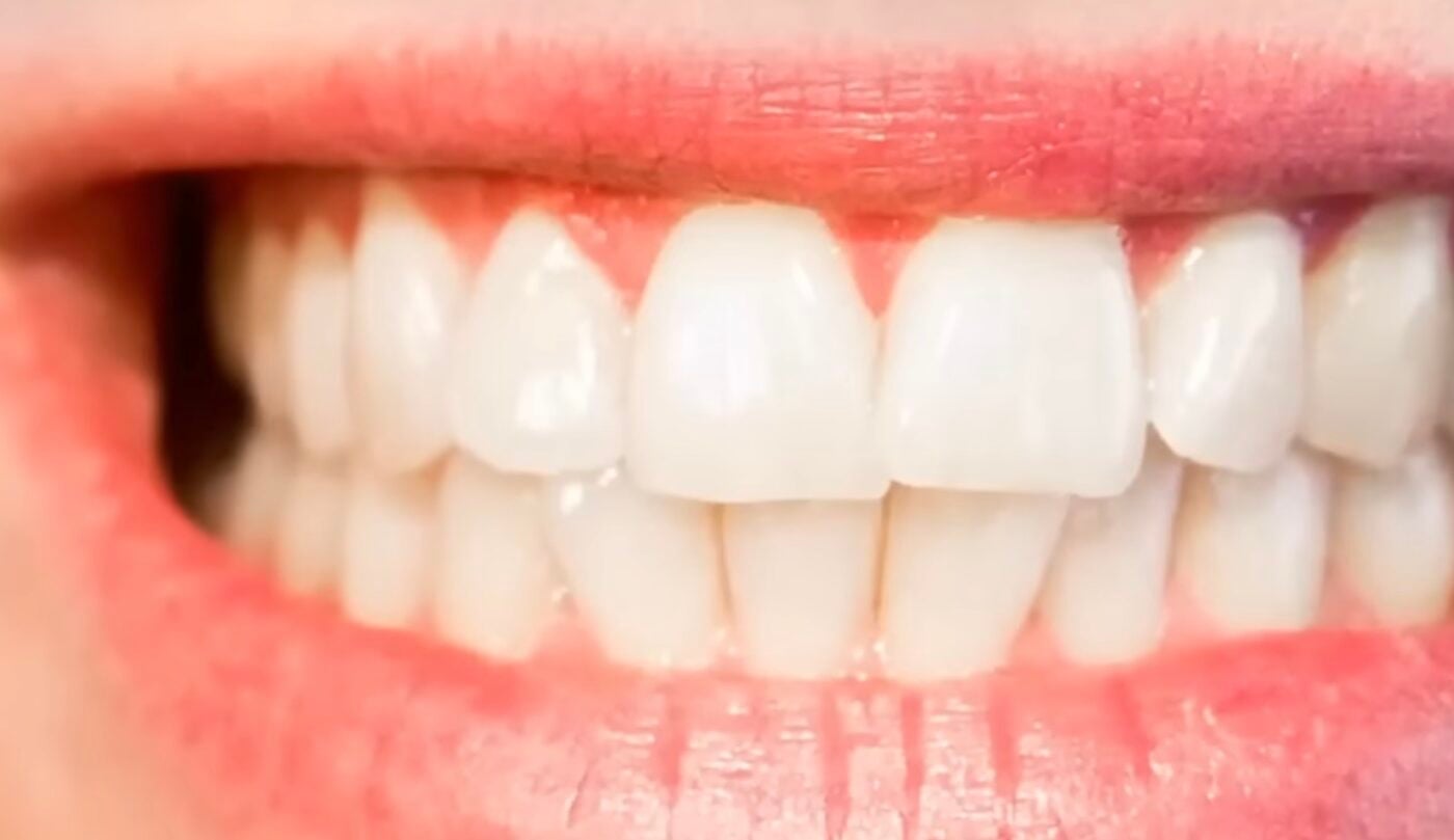 Як у домашніх умовах зробити зуби білішими